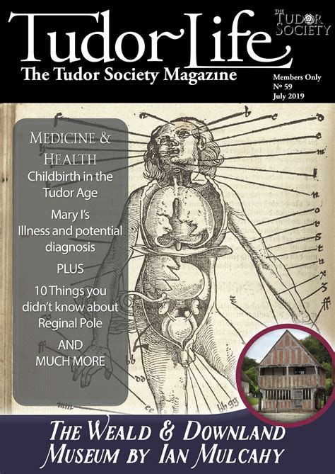 tudor illnesses and cures|tudor society health articles.